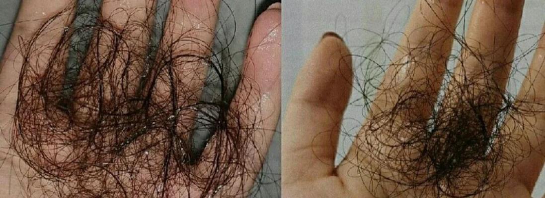 龙虎仙人球的正确养护方式是什么？